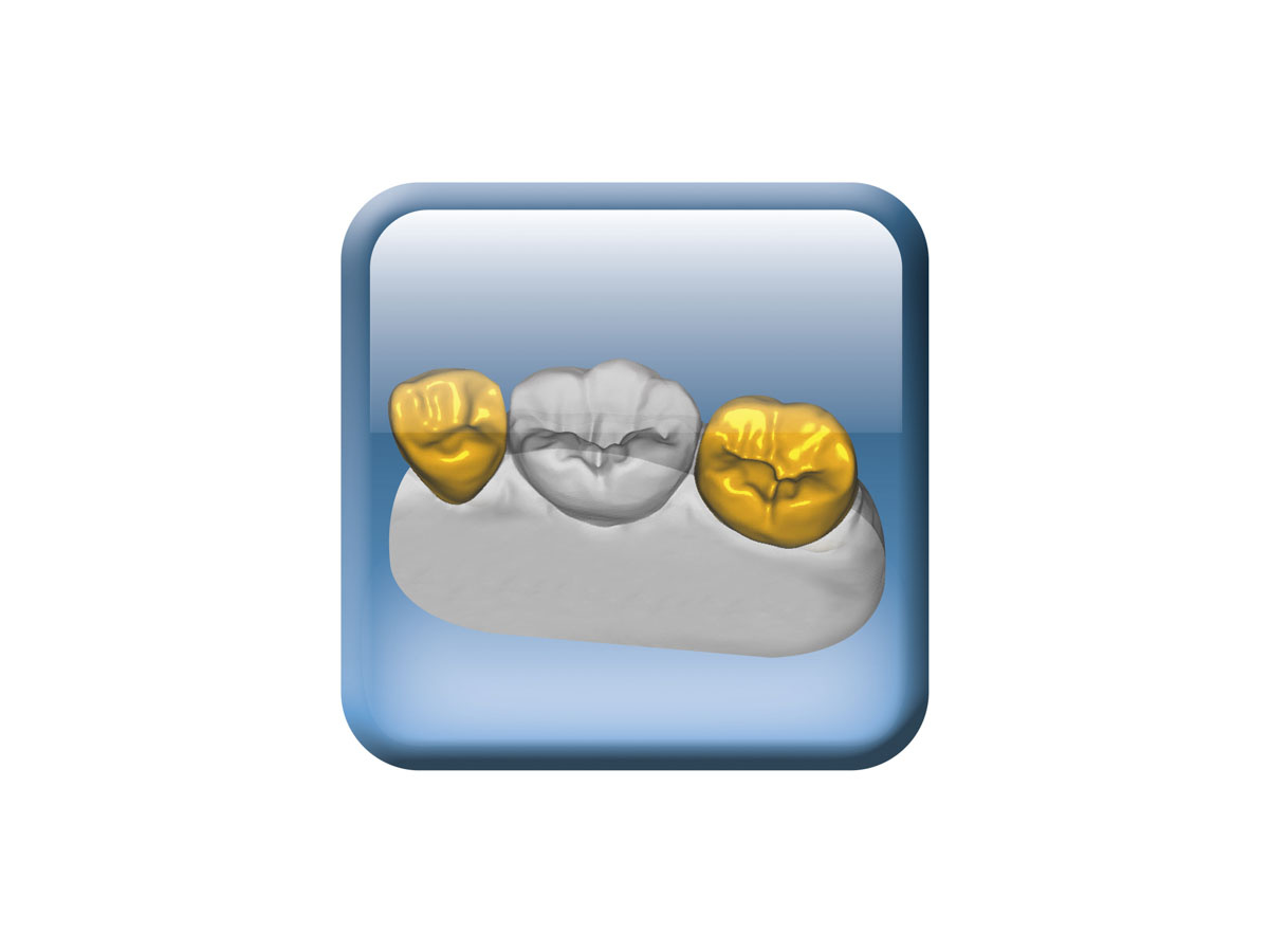 Zfx Provisional Crown & Bridges Software Upgrade Gold Quadrat Dental
